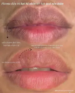 PMU Services in Ho Chi Minh City: What First-Time Clients Should Know 1 lip blush